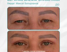 Клиника пластической хирургии Plastika Clinic (Пластика клиник), Примеры работ - фото 1