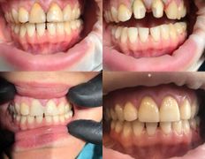 Стоматология AQstom (АКстом), Наши услуги - фото 16