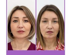 null Клиника пластической хирургии доктора Кобландина, Наши работы - фото 19