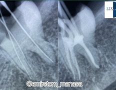 Стоматология AQstom (АКстом), Наши работы - фото 7