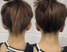 Клиника красоты и здоровья ЮТА, Отопластика - фото 4