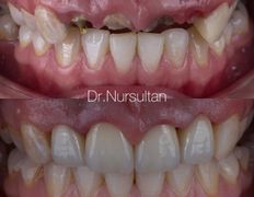 Стоматология One Dent (Уан Дент), Примеры работ - фото 5