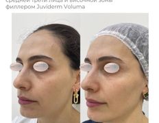 Медицинский центр ANNA Vi CLINICS (Анна Ви Клиникс), Наши работы - фото 8