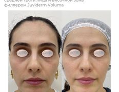 Медицинский центр ANNA Vi CLINICS (Анна Ви Клиникс), Наши работы - фото 12