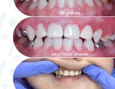 Стоматологический центр Kids Smile (Кидс Смайл), Примеры работ - фото 7
