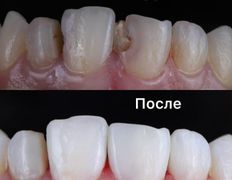 Стоматология One Dent (Уан Дент), Примеры работ - фото 3