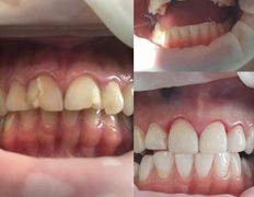 Стоматология AQstom (АКстом), Наши услуги - фото 13