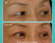 Клиника пластической хирургии Plastika Clinic (Пластика клиник), Примеры работ - фото 3