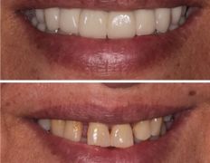 Стоматологическая клиника DentalPark (ДенталПарк), Работы - фото 4