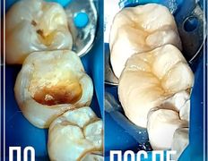 Стоматологическая клиника DentalPark (ДенталПарк), Работы - фото 8