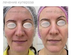 Медицинский центр ANNA Vi CLINICS (Анна Ви Клиникс), Наши работы - фото 9