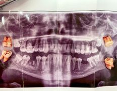 Стоматология AQstom (АКстом), Наши работы - фото 5