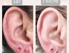 Медицинский центр Ultraline (Ультралайн), До/После - фото 5