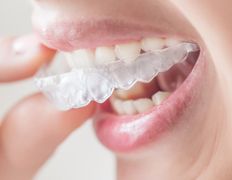 Стоматологический кабинет Айнабулак Дент, Примеры работ - фото 17