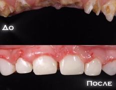 Стоматология One Dent (Уан Дент), Примеры работ - фото 4