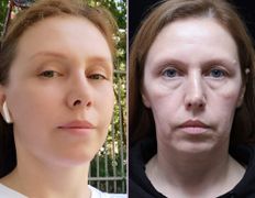 null Клиника пластической хирургии доктора Кобландина, Примеры работ - фото 16