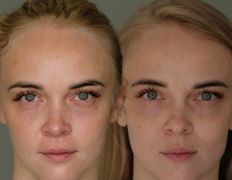 Клиника пластической хирургии Plastika Clinic (Пластика клиник), Примеры работ - фото 17