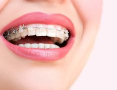 Стоматологический кабинет Айнабулак Дент, Примеры работ - фото 18