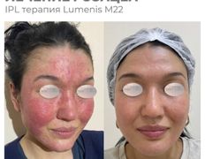 Медицинский центр ANNA Vi CLINICS (Анна Ви Клиникс), Наши работы - фото 4