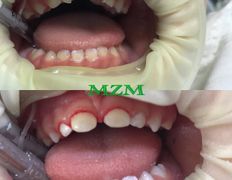 Стоматология AQstom (АКстом), Наши услуги - фото 8