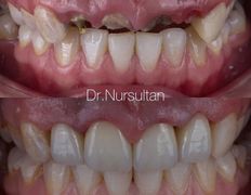 Стоматология One Dent (Уан Дент), Примеры работ - фото 5