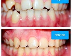 Стоматология Bas dent (Бас дент), Примеры работ - фото 7