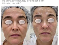 Медицинский центр ANNA Vi CLINICS (Анна Ви Клиникс), Наши работы - фото 2