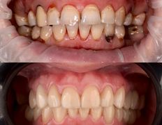 Стоматологический центр Whitestory (Уайтстори), Примеры работ - фото 4