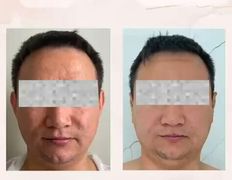 Медицинский центр Ultraline (Ультралайн), До/После - фото 2