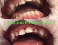 Стоматология AQstom (АКстом), Наши услуги - фото 6