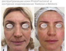 Медицинский центр ANNA Vi CLINICS (Анна Ви Клиникс), Наши работы - фото 15