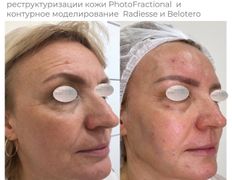 Медицинский центр ANNA Vi CLINICS (Анна Ви Клиникс), Наши работы - фото 17