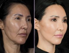 null Клиника пластической хирургии доктора Кобландина, Примеры работ - фото 19