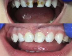 Стоматология AQstom (АКстом), Наши работы - фото 6