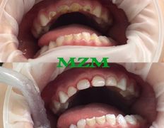 Стоматология AQstom (АКстом), Наши услуги - фото 18