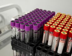 Центр гастроэнтерологии и диетологии  GASTROMED (ГАСТРОМЕД), Галерея - фото 10