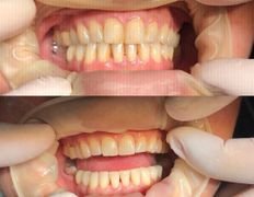 Стоматология AQstom (АКстом), Наши услуги - фото 10