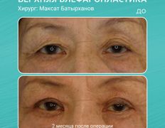 Клиника пластической хирургии Plastika Clinic (Пластика клиник), Примеры работ - фото 14