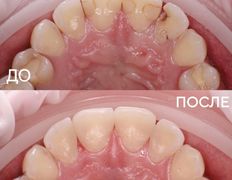 Стоматология My Dent (Май Дент), Примеры работ - фото 10