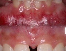 Стоматология One Dent (Уан Дент), Примеры работ - фото 1