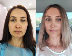 null Клиника пластической хирургии доктора Кобландина, Примеры работ - фото 17