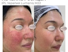 Медицинский центр ANNA Vi CLINICS (Анна Ви Клиникс), Наши работы - фото 5