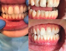 Стоматология AQstom (АКстом), Наши услуги - фото 12