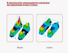 Центр подологии и эндокринологии Diafoot.kz (Диафут.кз), Диабетическая обувь - фото 3
