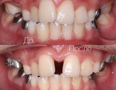 Стоматология One Dent (Уан Дент), Примеры работ - фото 3