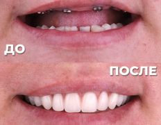 Стоматология My Dent (Май Дент), Примеры работ - фото 16
