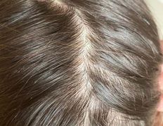 Медицинский центр лечения волос и кожи головы АМД Лаборатории, Примеры работ - фото 8