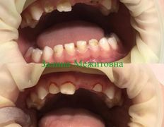 Стоматология AQstom (АКстом), Наши услуги - фото 2