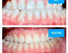 Стоматология Bas dent (Бас дент), Примеры работ - фото 6