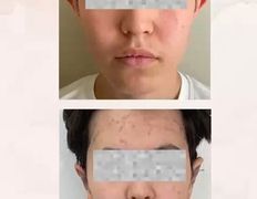 Медицинский центр Ultraline (Ультралайн), До/После - фото 1